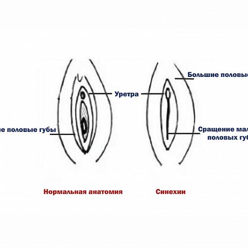 Малые половые губы схема