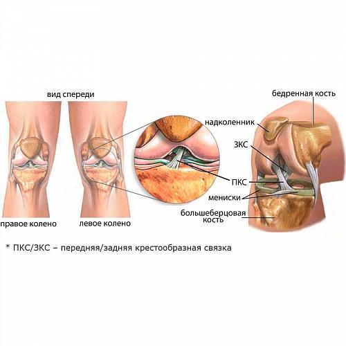 Крестообразные связки и мениски коленного
